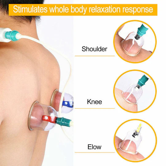 VACUUM MASSAGE CUPPING KIT ACUPUNCTURE SUCTION MASSAGER PAIN RELIEF 32 CUPS SET