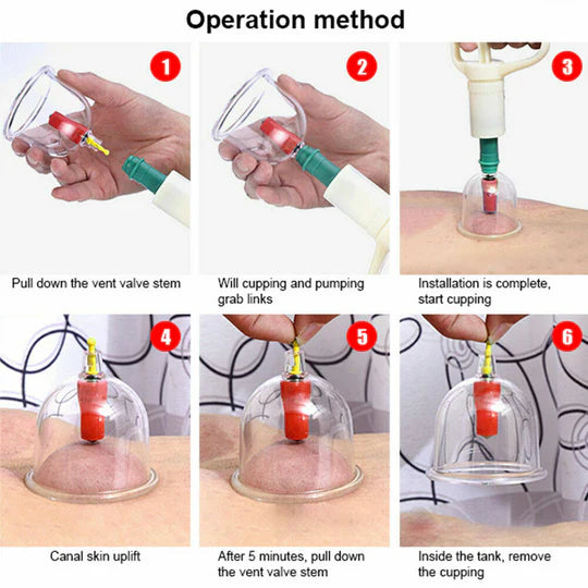 VACUUM MASSAGE CUPPING KIT ACUPUNCTURE SUCTION MASSAGER PAIN RELIEF 32 CUPS SET