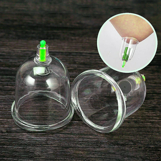 24 CUPS VACUUM CUPPING SET MASSAGE KIT ACUPUNCTURE SUCTION MASSAGER PAIN RELIEF