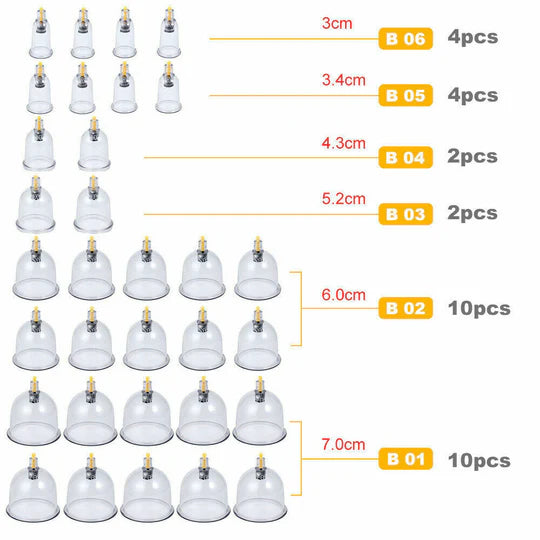 VACUUM MASSAGE CUPPING KIT ACUPUNCTURE SUCTION MASSAGER PAIN RELIEF 32 CUPS SET